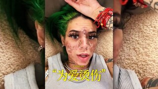 「为爱烫伤」被网友逼到说出自己受伤的经历😂