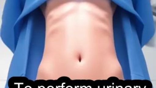 To perform urinary diversion surgery #Urinary #Diversion #Surgery #Doctor #Makes