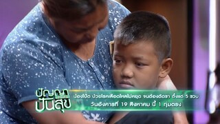 ปัญญาปันสุข 'น้องโน๊ต' ป่วยโรคเลือดไหลไม่หยุดจนต้องตัดขา วันอังคารที่ 19 ส.ค. เวลา 19.00 น.