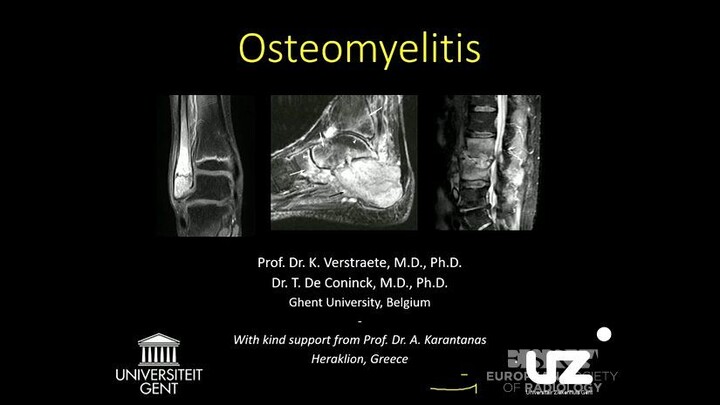 Osteomyelitis MSK Radiology