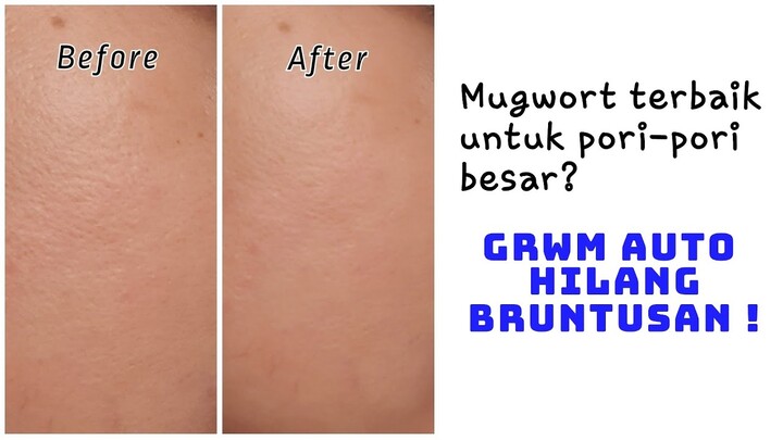 Mugwort terbaik untuk pori-pori besar?  GRWM auto hilang bruntusan !