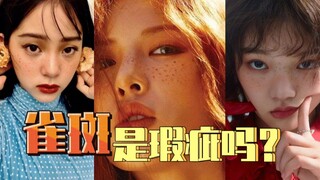 Tàn nhang có phải là khuyết điểm không?