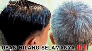 cara menghitamkan rambut tanpa semir | rambut uban hilang selamanya