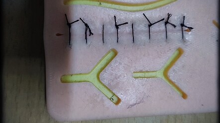 The average medical student spends two years practicing suturing.