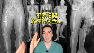 ⚠️TW⚠️不要把腿放在仪表盘上