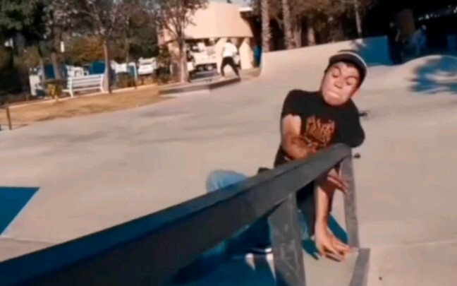 Đau đến mức không thở nổi, mọi người hãy chú ý an toàn và lấy đó làm bài học!