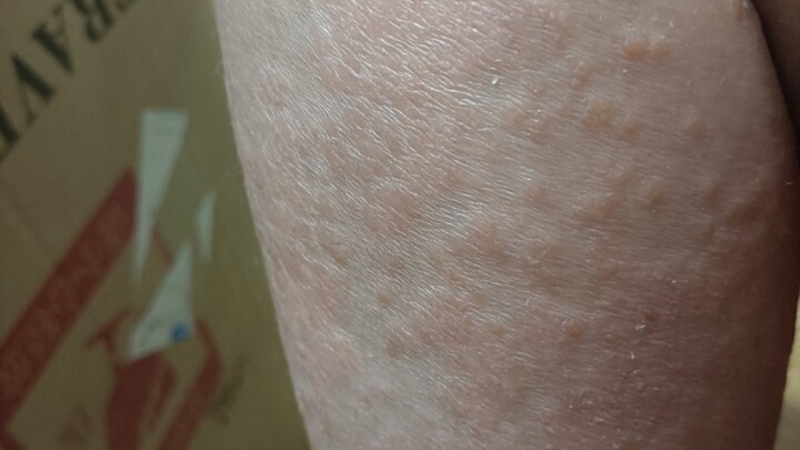I think having a healthy body is already the best thing in the world.