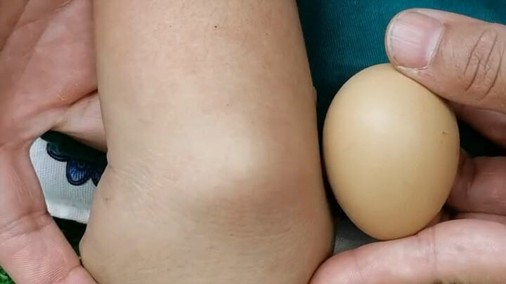 Đánh bay u nang bao hoạt dịch trong giây lát