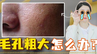 What should you do about enlarged pores? A dermatologist teaches you the solution!