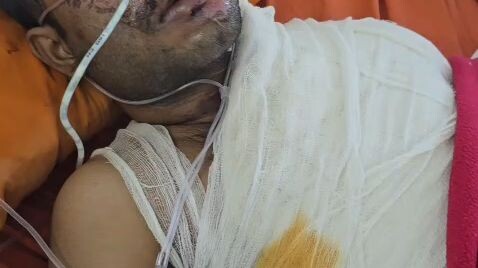বিদুৎ এর কাজ করার সময় দূর্ঘনা👷‍♂️