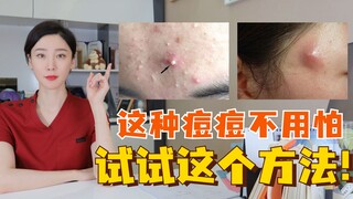 脸上长了这种痘痘不用怕，试试这个方法！痘痘/痘印一网打尽！