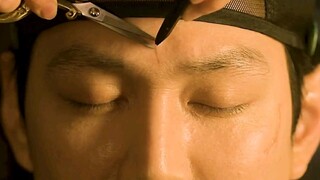 Operasi Wajah Paling Mengerikan