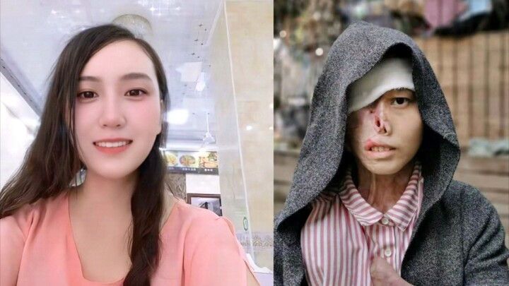 At the youthful age of twenty-three, a cruel accident completely changed my life. Sometimes I feel l