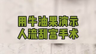 Miss Avocado said that dilation and curettage is very uncomfortable, so everyone please take good ca