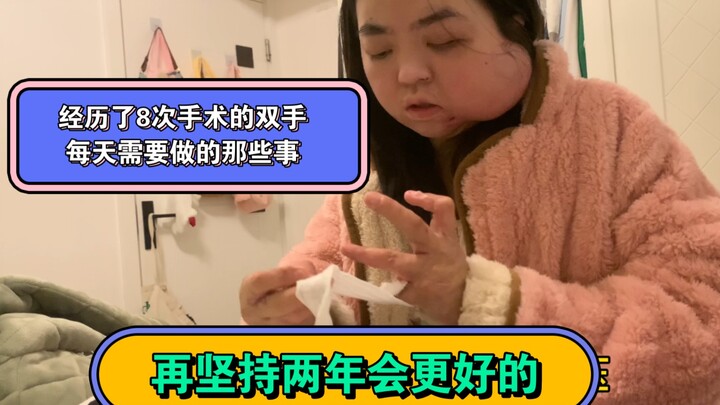 Tôi mong chờ đến ngày mình có thể tự buộc tóc.