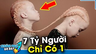 7 Đứa Trẻ Độc Lạ và Khác Thường Nhất...Trong 7 Tỷ Người Hiếm Lắm Mới Có 1| KHÁM PHÁ ĐÓ ĐÂY