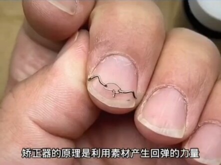 أغرب الحركات التي تراها لأول مرة