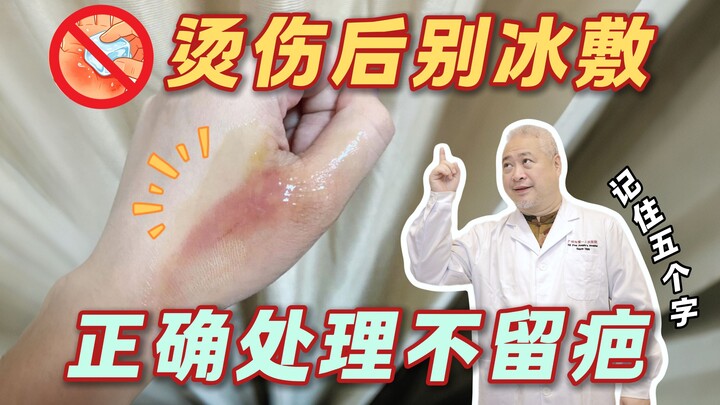 【Giáo dục khoa học】Sơ cứu bỏng: Năm nào cũng phổ biến kiến thức, năm nào cũng có người làm sai! Nên 