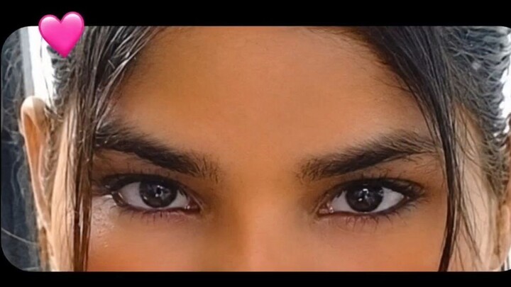 Eye 👀 killer 😻