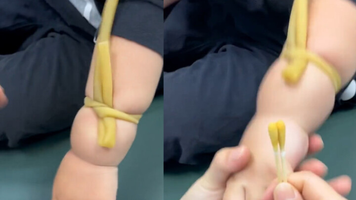 ممرّضة تُعطي المحقن لطفل سمين تُظهر مهارة فائقة: تحدّد موقع الوريد ببضع ثوانٍ من التحسّس بالأصابع...