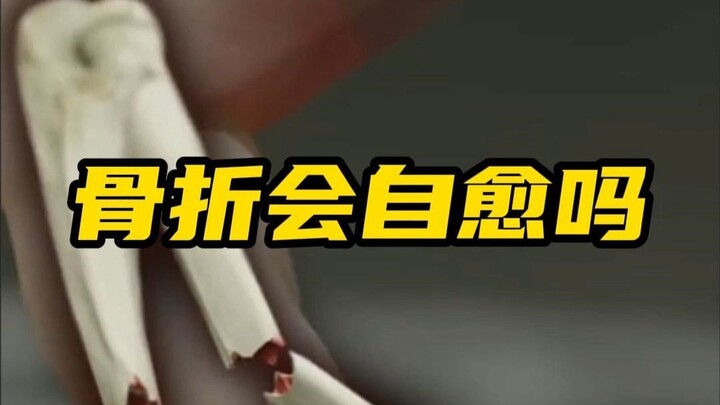 Apakah patah tulang bisa sembuh sendiri?