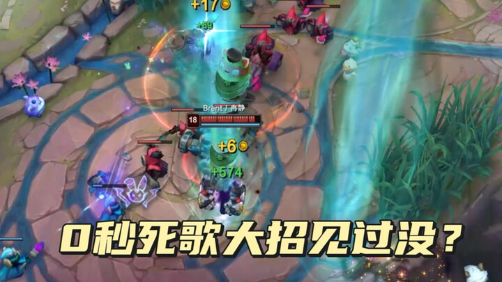 Deadly Song’s new high-tech combo: Axiom Arc paired with the Tooth Fairy—can you spam your ultimate 