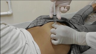 intramuscular injection