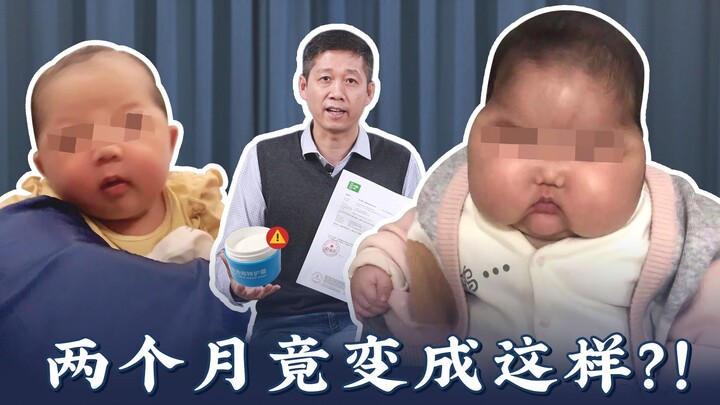 "Bayi Berkepala Besar" Kembali Lagi?! Kebenaran di Baliknya Mengejutkan!