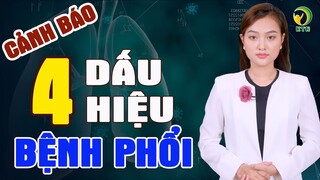 Cảnh báo 4 dấu hiệu liên quan đến phổi, ho kéo dài trên 3 tuần cần đi khám ngay — KHỎE TỰ NHIÊN