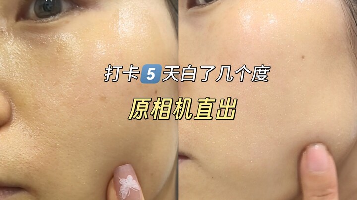 Turns out, yellowish skin really can become fair!!