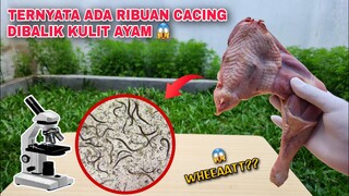 EKSPERIMEN: KEHIDUPAN DIBALIK KULIT AYAM