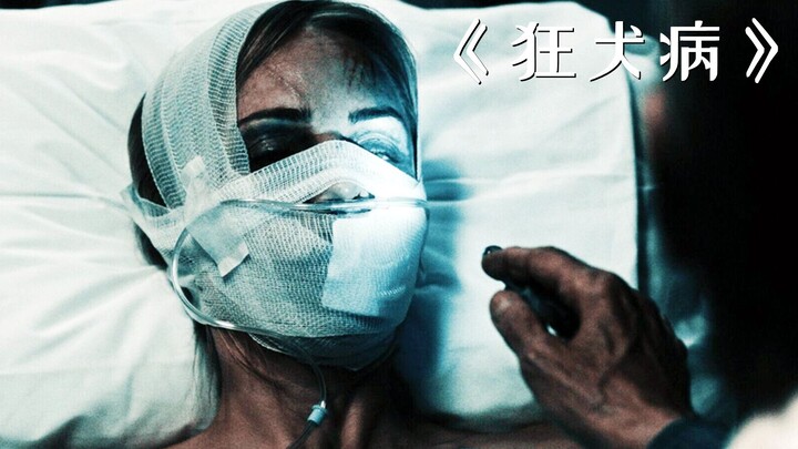 สาวน้อยทำศัลยกรรมเสริมความงามฟรี แต่กลับกลายเป็นจุดเริ่มต้นของเชื้อไวรัสพิษสุนัขบ้า! “โรคพิษสุนัขบ้า