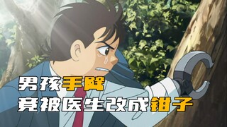 男孩的手臂，竟被医生改造成了钳子！