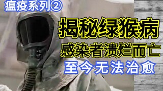 【Ge Ge】A super virus that outsmarts humans—infected individuals vomit their internal organs and die 