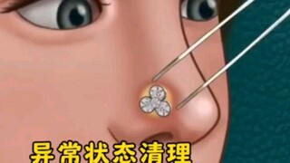 关于异常状态的清理