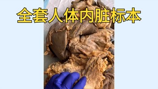 جميع أعضائك الداخلية موجودة هنا