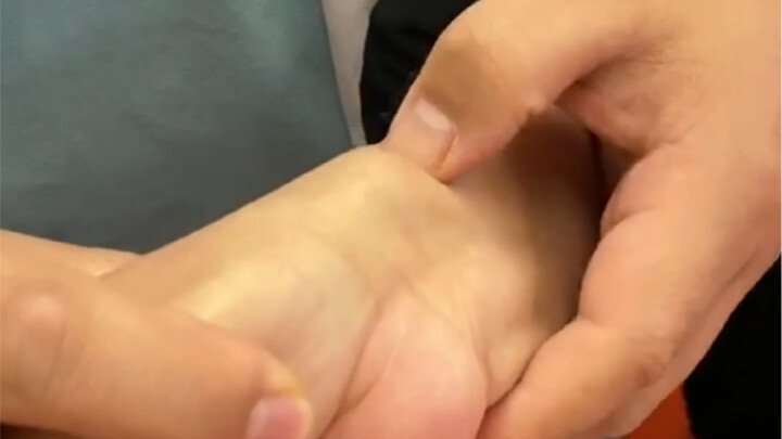 إزالة كيسة الجراب الوترية في لحظة!