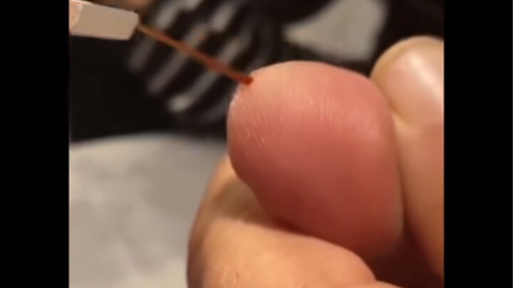 “Stress-Relief Lab”: Watch a foreign guy pull out splinters—picking at them reveals just how long th