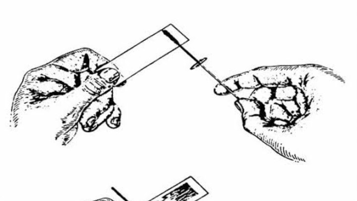 Histopath 2nd Section
