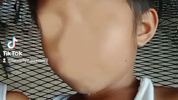 ney ano n nangyari s mukha nyo ay