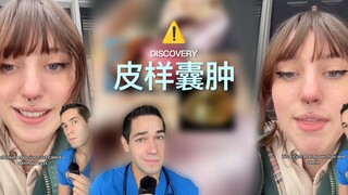 พบกับซีสต์เดอร์มอยด์ที่ทำให้เส้นผม ฟัน และแม้แต่ดวงตาเติบโต