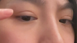 Can eyelids be repaired?