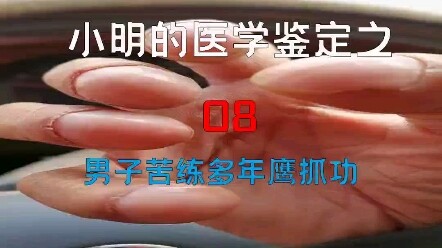 【Giám định y học】 Giám định các bệnh phổ biến trên mạng 08
