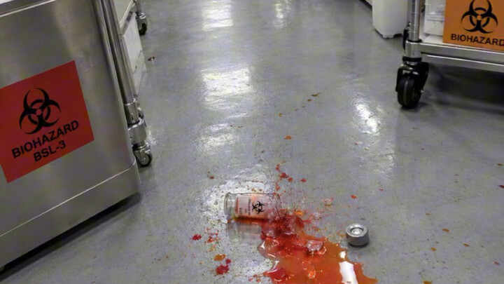 A netizen from abroad said: “On my very first day at work, I accidentally broke a plague virus test 