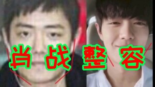 Xiao Zhan's plastic surgery confirmed! Let's see what she had done