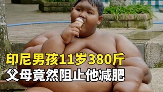 Indonesia's heaviest chubby kid, 11 years old and weighing 380 jin, is in life-threatening danger, y