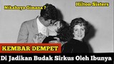 KEMBAR SIAM DEMPET | Paling Menyedihkan - Hilton Sisters