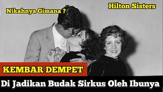 KEMBAR SIAM DEMPET | Paling Menyedihkan - Hilton Sisters