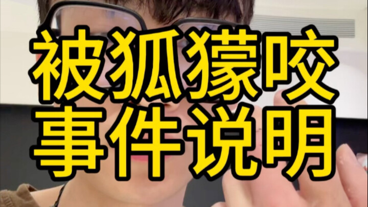 Let me clarify about being bitten by a meerkat yesterday. Meerkats do bite people, but not as freque