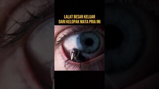 RIBUAN LALAT KELUAR DARI TUBUH PRIA INI #alurceritafilm #film